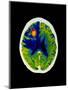 Coloured CT Scan of Brain Abscess In AIDS Patient-Science Photo Library-Mounted Premium Photographic Print