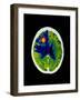 Coloured CT Scan of Brain Abscess In AIDS Patient-Science Photo Library-Framed Photographic Print