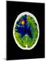 Coloured CT Scan of Brain Abscess In AIDS Patient-Science Photo Library-Mounted Photographic Print