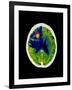 Coloured CT Scan of Brain Abscess In AIDS Patient-Science Photo Library-Framed Photographic Print