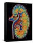 Coloured CT Scan Through a Healthy Human Kidney-PASIEKA-Framed Stretched Canvas