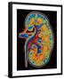 Coloured CT Scan Through a Healthy Human Kidney-PASIEKA-Framed Photographic Print