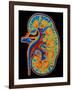 Coloured CT Scan Through a Healthy Human Kidney-PASIEKA-Framed Photographic Print