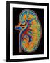 Coloured CT Scan Through a Healthy Human Kidney-PASIEKA-Framed Photographic Print