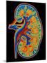 Coloured CT Scan Through a Healthy Human Kidney-PASIEKA-Mounted Photographic Print