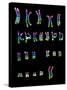 Coloured LM of a Normal Female Karyotype-L. Willatt-Stretched Canvas