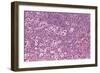 Coloured LM of Hodgkin's Disease In Lymph Tissue-Dr. E. Walker-Framed Photographic Print
