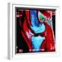 Coloured MRI Scan of Human Knee Joint, Side View-Geoff Tompkinson-Framed Premium Photographic Print