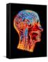Coloured MRI Scan of the Human Head (side View)-PASIEKA-Framed Stretched Canvas