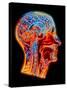 Coloured MRI Scan of the Human Head (side View)-PASIEKA-Stretched Canvas