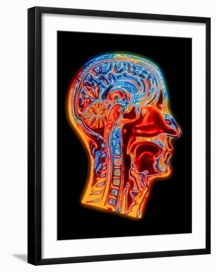 Coloured MRI Scan of the Human Head (side View)-PASIEKA-Framed Photographic Print