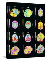 Coloured MRI Scans of Human Brain (multiple Views)-Mehau Kulyk-Stretched Canvas
