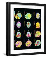 Coloured MRI Scans of Human Brain (multiple Views)-Mehau Kulyk-Framed Photographic Print