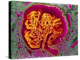 Coloured SEM of a Renal Glomerulus-null-Stretched Canvas