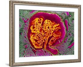 Coloured SEM of a Renal Glomerulus-null-Framed Photographic Print