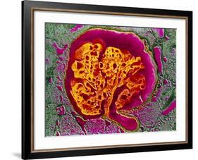 Coloured SEM of a Renal Glomerulus-null-Framed Photographic Print