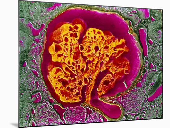 Coloured SEM of a Renal Glomerulus-null-Mounted Photographic Print
