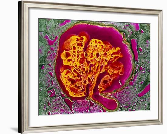 Coloured SEM of a Renal Glomerulus-null-Framed Photographic Print
