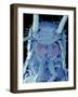 Coloured SEM of a Silverfish (order Thysanura)-Volker Steger-Framed Photographic Print