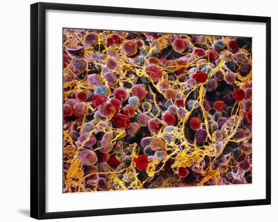 Coloured SEM of Adipose Tissue Showing Fat Cells-null-Framed Photographic Print