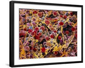 Coloured SEM of Adipose Tissue Showing Fat Cells-null-Framed Photographic Print