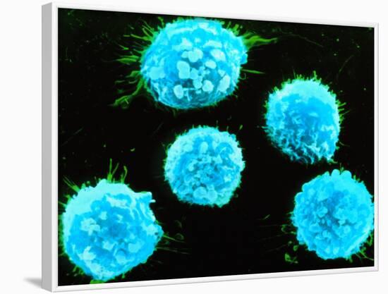 Coloured SEM of B-lymphocyte White Blood Cells-null-Framed Photographic Print