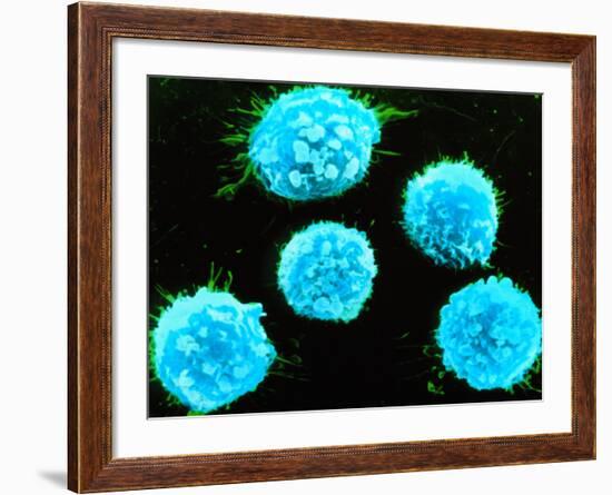 Coloured SEM of B-lymphocyte White Blood Cells-null-Framed Photographic Print