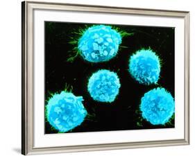 Coloured SEM of B-lymphocyte White Blood Cells-null-Framed Photographic Print