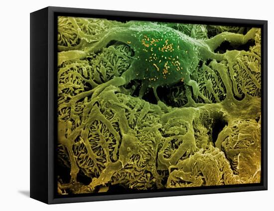 Coloured SEM of Podocytes In the Human Kidney-Steve Gschmeissner-Framed Stretched Canvas