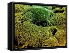 Coloured SEM of Podocytes In the Human Kidney-Steve Gschmeissner-Framed Stretched Canvas