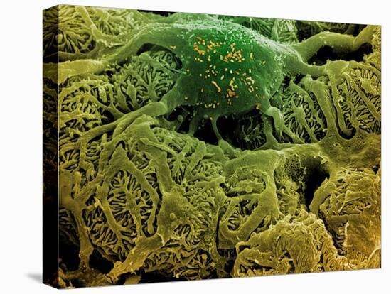 Coloured SEM of Podocytes In the Human Kidney-Steve Gschmeissner-Stretched Canvas