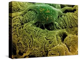 Coloured SEM of Podocytes In the Human Kidney-Steve Gschmeissner-Stretched Canvas