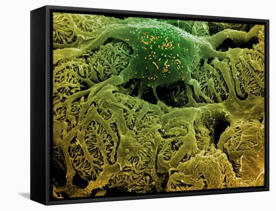 Coloured SEM of Podocytes In the Human Kidney-Steve Gschmeissner-Framed Stretched Canvas