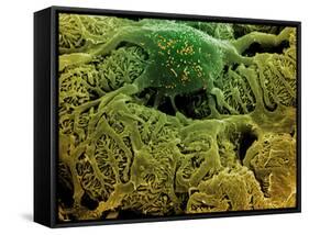 Coloured SEM of Podocytes In the Human Kidney-Steve Gschmeissner-Framed Stretched Canvas