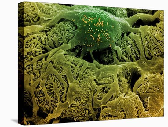 Coloured SEM of Podocytes In the Human Kidney-Steve Gschmeissner-Stretched Canvas