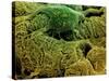 Coloured SEM of Podocytes In the Human Kidney-Steve Gschmeissner-Stretched Canvas