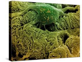 Coloured SEM of Podocytes In the Human Kidney-Steve Gschmeissner-Stretched Canvas