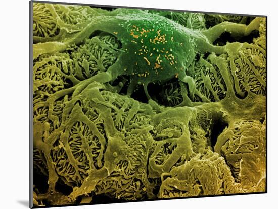 Coloured SEM of Podocytes In the Human Kidney-Steve Gschmeissner-Mounted Photographic Print