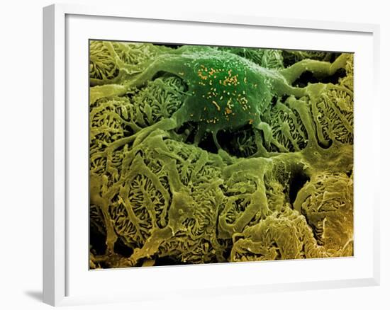 Coloured SEM of Podocytes In the Human Kidney-Steve Gschmeissner-Framed Photographic Print