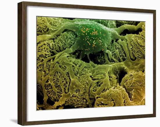 Coloured SEM of Podocytes In the Human Kidney-Steve Gschmeissner-Framed Photographic Print