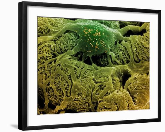 Coloured SEM of Podocytes In the Human Kidney-Steve Gschmeissner-Framed Photographic Print