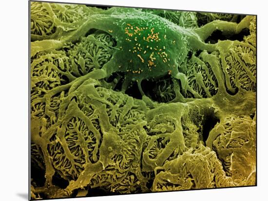 Coloured SEM of Podocytes In the Human Kidney-Steve Gschmeissner-Mounted Photographic Print