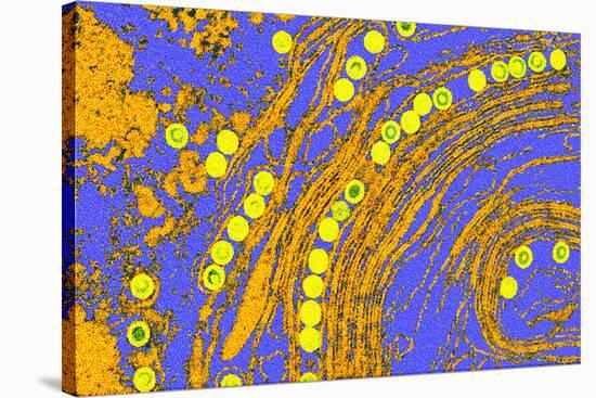 Coloured TEM of Herpes Simplex Viruses Inside Cell-Dr. Linda Stannard-Stretched Canvas