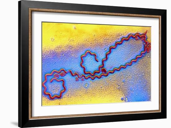 Coloured TEM of Leptospira Sp. Bacterium-null-Framed Photographic Print