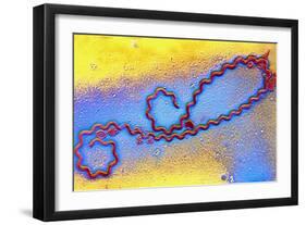 Coloured TEM of Leptospira Sp. Bacterium-null-Framed Photographic Print