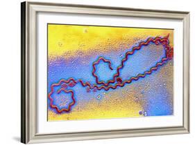 Coloured TEM of Leptospira Sp. Bacterium-null-Framed Photographic Print