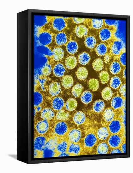 Coloured TEM of Rotaviruses-null-Framed Stretched Canvas