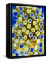 Coloured TEM of Rotaviruses-null-Framed Stretched Canvas