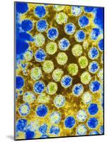 Coloured TEM of Rotaviruses-null-Mounted Photographic Print