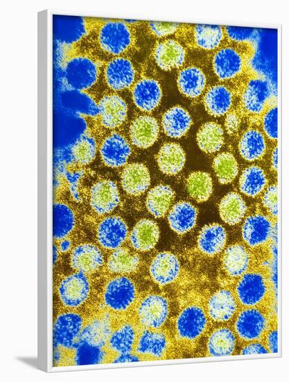 Coloured TEM of Rotaviruses-null-Framed Photographic Print